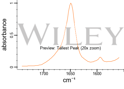 Bupivacaine | C18H28N2O | CID 2474 - PubChem